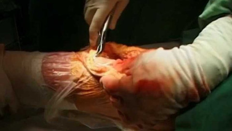 Diagnóza - Artróza kolenního kloubu