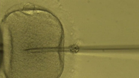 Alchymie bytí - Zázrak zrození