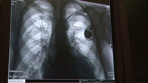 Medicína pro 21. století - Chronická obstrukční plicní nemoc