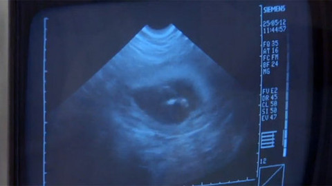 Pološero - Pološero s hvězdičkou - Orgány na prodej