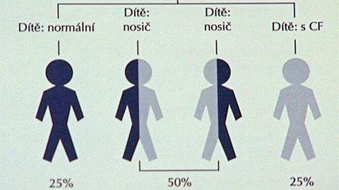 Na pomoc životu - Naděje pro slané děti