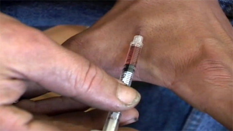 Medicína pro 21. století - Drogová závislost jako choroba