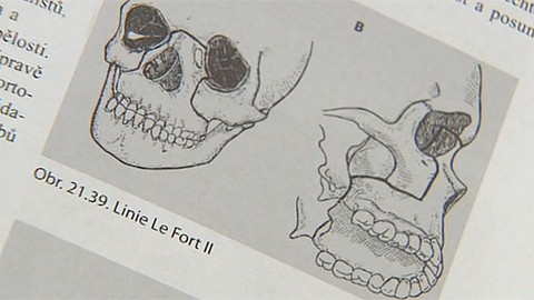 Tep 24 - 17. listopadu 2012