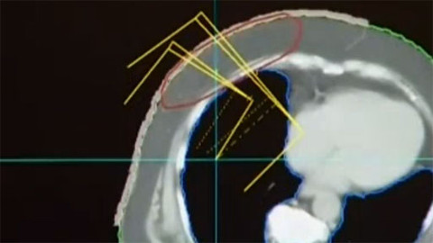 Alchymie bytí - Anémie a únava