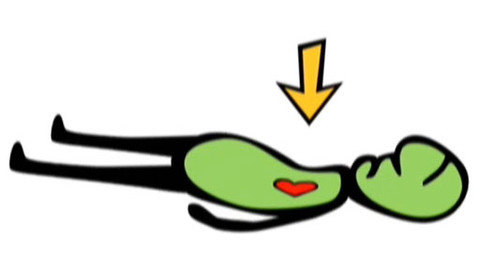 Dětská záchranka v akci - Zástava srdce