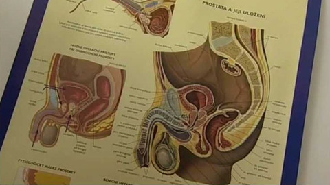 Na pomoc životu - Rakovina prostaty
