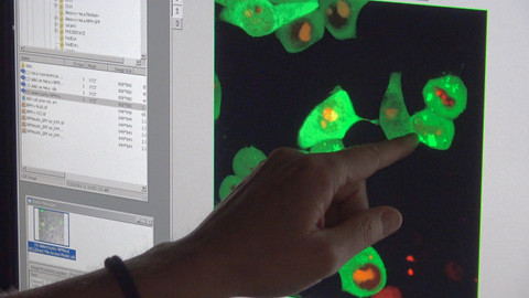 Příběhy moderní medicíny - Imunoterapie - léčba budoucnosti