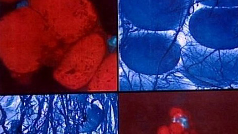 Pod pokličkou - S kolagenem v těle hýbete se směle