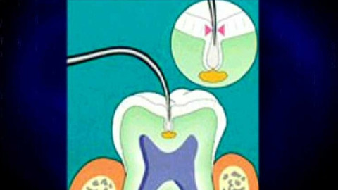 Popularis - 3. července 2003