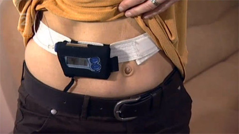 Na pomoc životu - Cukrovka