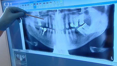 Černé ovce - 7. března 2016