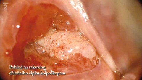 Alchymie bytí - Na co umírají ženy