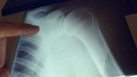 Diagnóza - Onemocnění prostaty