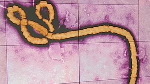 Horizont ČT24 - 31. července 2014