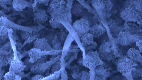 Alchymie bytí - Invazivní mykózy