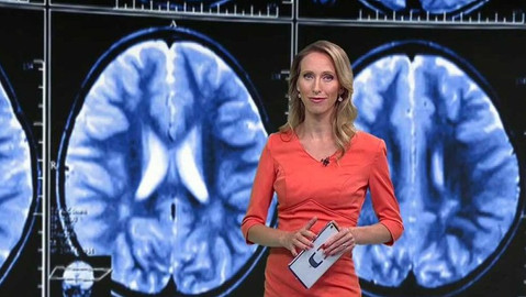 Horizont ČT24 - 1. srpna 2018