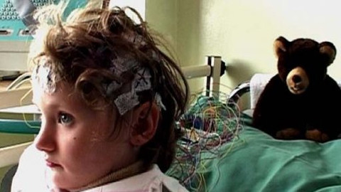 Diagnóza - Epilepsie u dětí