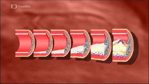 Popularis - 24. ledna 2006