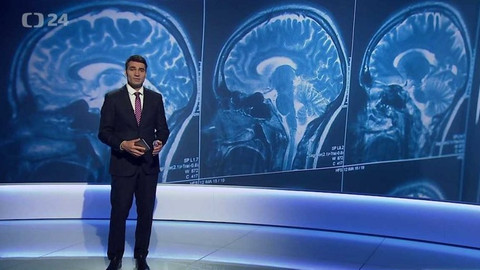 Věda 24 - 21. března 2021