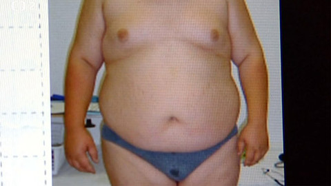 Při prevenci máte větší šanci - 8/8 Dětská obezita