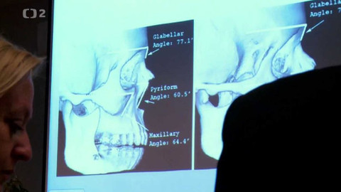 Doktoři - 5/8 Český národ je vynalézavý...