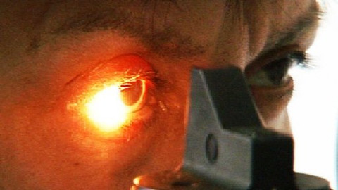 Diagnóza - Rekonstrukce oka