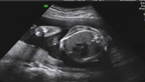 Rodinné křižovatky - Ultrazvukový večírek