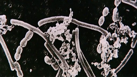 Pod pokličkou - Co zničí antibiotika, zachrání probiotika