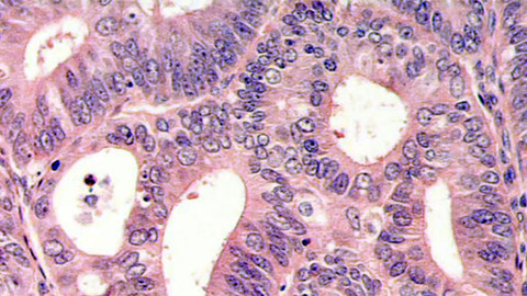 Tep 24 - 23. února 2013