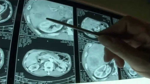 Diagnóza - Operace jater