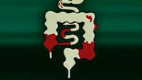 Diagnóza - Crohnova choroba