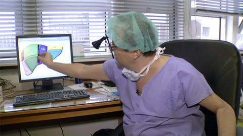 Moje medicína - Resekce jaterních metastáz