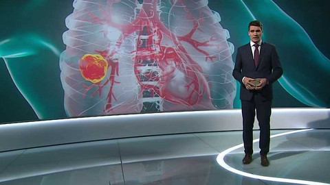 Věda 24 - 20. listopadu 2022