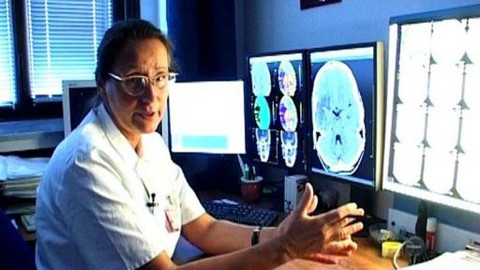 Diagnóza - Cévní mozková příhoda