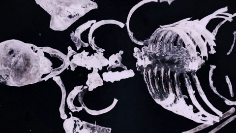 Legendy kriminalistiky - 10/10 Interpol