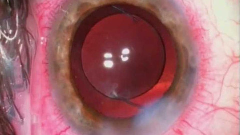 Diagnóza - Medicína a stáří