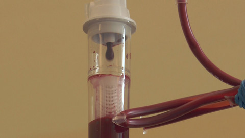 Příběhy moderní medicíny - Leukémie v 21. století