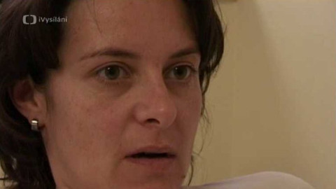 Diagnóza - Downův syndrom