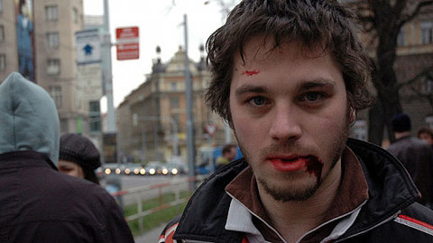 Efekt přihlížejícího