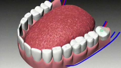 PORT - Port / Brána