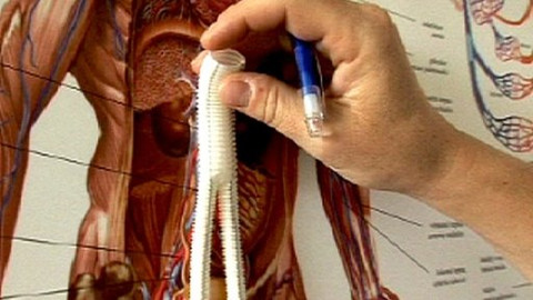 Diagnóza - Robotická cévní operace