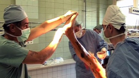 Diagnóza - Křečové žíly