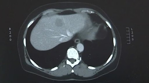 Tep 24 - 15. června 2013