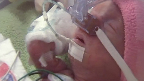 Pološero - Porody podomácku