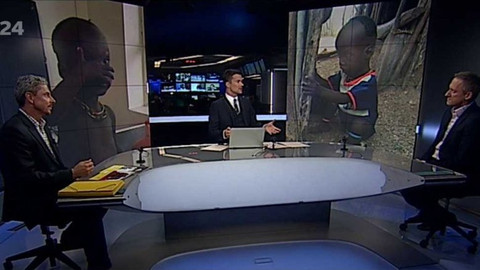 90’ ČT24 - Léčba šedého zákalu u dětí v Africe