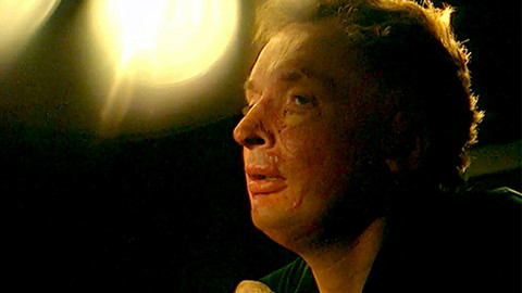 Jak se žije... - Jak se žije s poznamenanou tváří podle Zdeňka Podskalského II