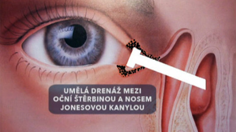 Tep 24 - 4. června 2011