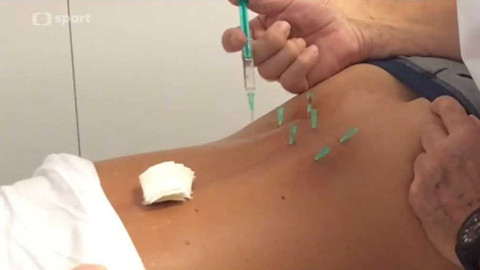 Olympijský magazín - 24. května 2017