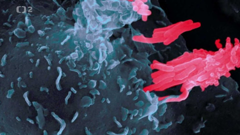 Dobrodružství vědy a techniky - Tuberkulóza - číhající hrozba