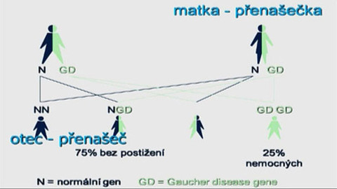 Medicína pro 21. století - Gaucherova choroba
